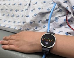 Galaxy Watch6 sincope: ora il watch la predice