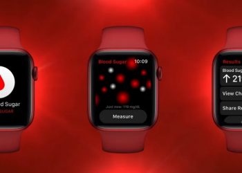 Glucosio Apple Watch: segnali incoraggianti